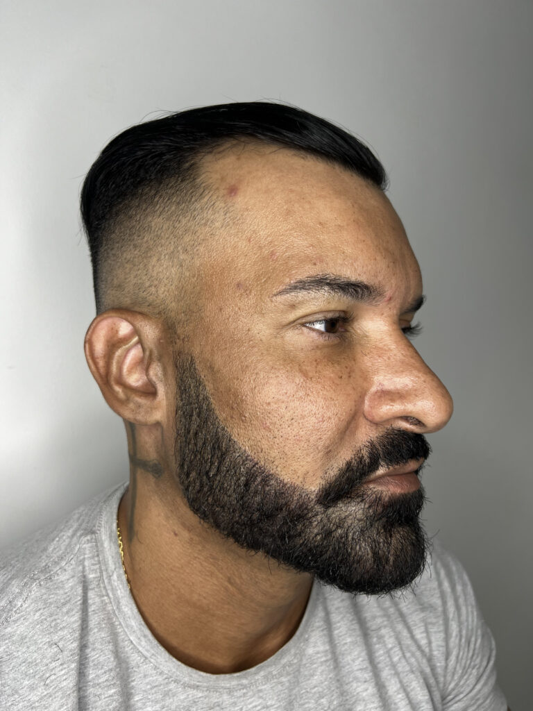 micropigmentacion de barba - Fabiano SMP